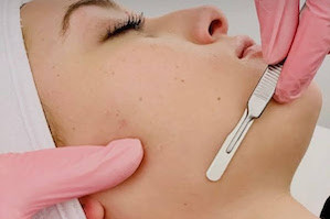 thumb-dermaplaning