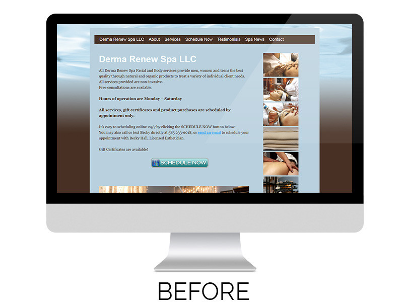 Derma Renew - Before