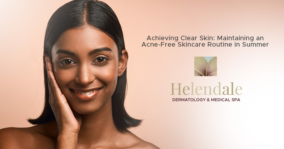 Achieving Clear Skin: Maintaining an Acne-Free Skincare Routine in Summer