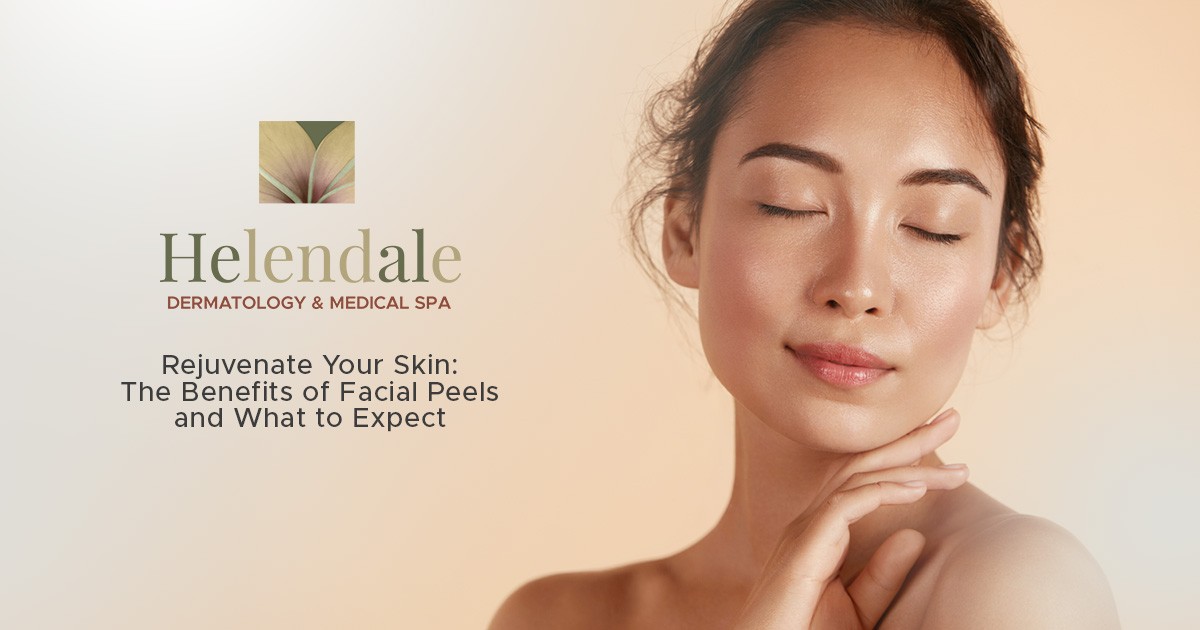 Rejuvenate Your Skin: The Benefits of Facial Peels and What to Expect