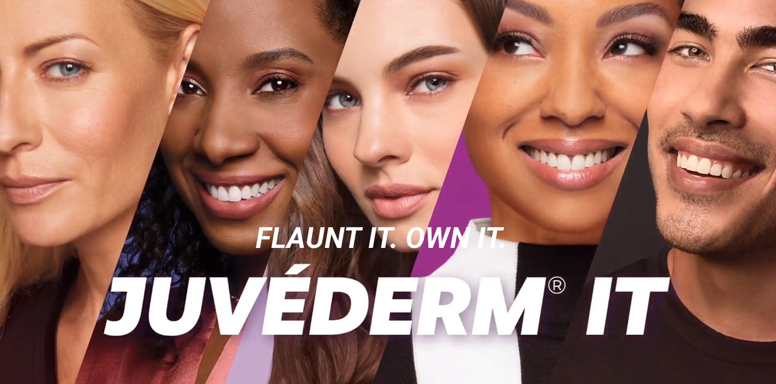 Juvederm It