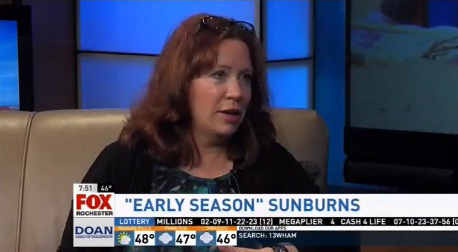 Doctor Elizabeth Arthur, MD on Fox Rochester about early season sunburns; weather and news ticker shown.