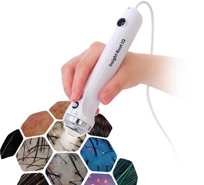 Insight Root IQ device