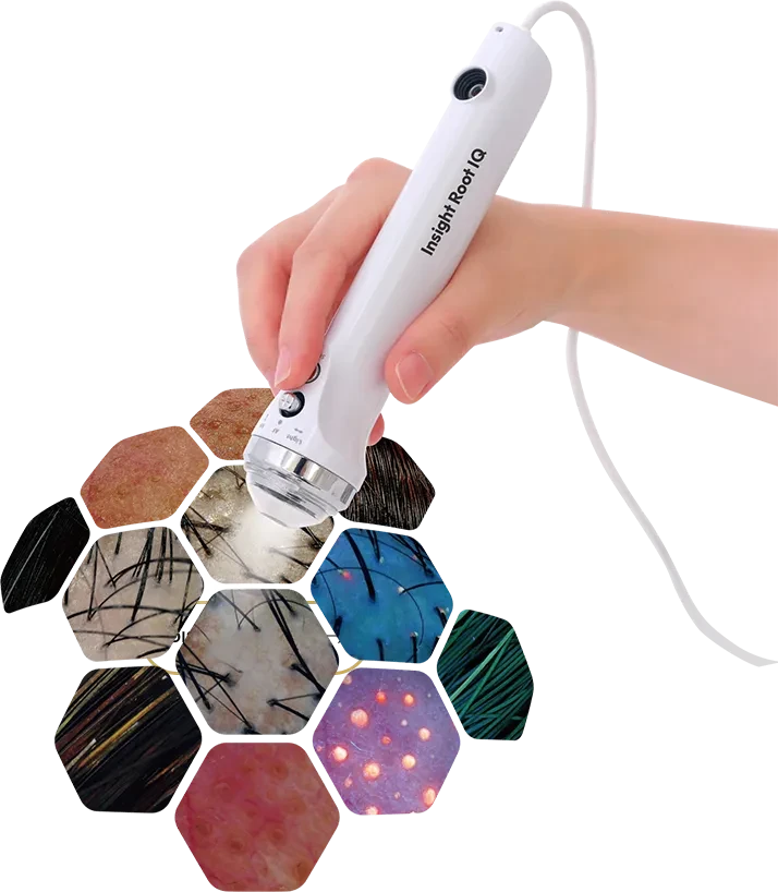 A hand holding a handheld device with skin and hair close-up images underneath.