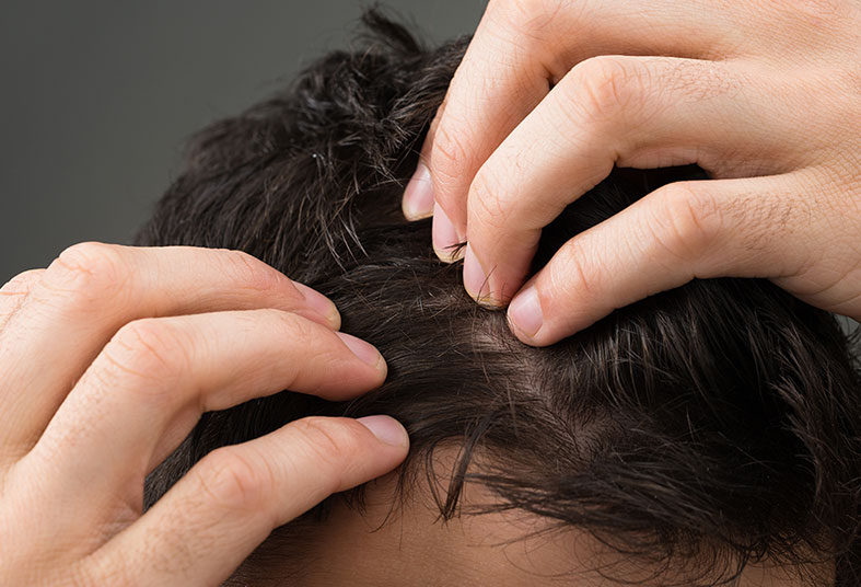 Innovative hair restoration