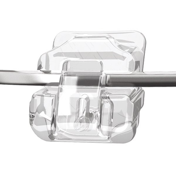 Clear ceramic orthodontic bracket attached to a metal archwire, used for dental braces.