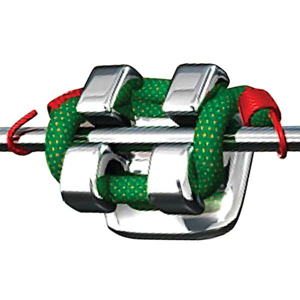 traditional braces rendering